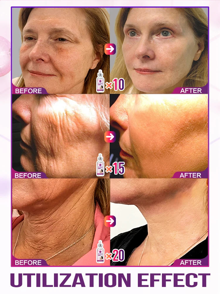 Anti-aging solution for facial problems