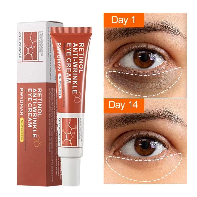 Retinol Anti-wrinkle Eye Cream Remove Eye Bags Dark Circles Fade Fine Lines Anti-Aging Puffiness Firm Brighten Eye Care Unisex