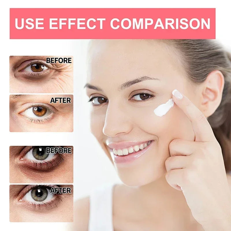 Anti-wrinkle Eye Cream Retinol Eye Cream Brightening Firming Eye Firming Anti-aging Moisturising Whitening Brightening Skin Care