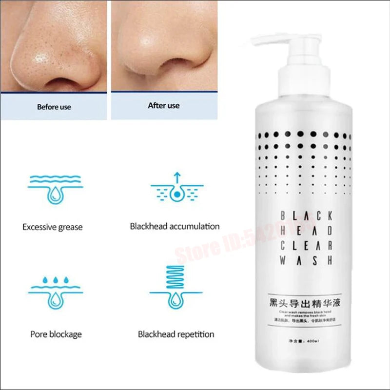 Nose Blackhead Peeling Solution Serum Facial Cleaning Liquid Scrub Special Solution Skin Deep Cleaning For Small Bubble