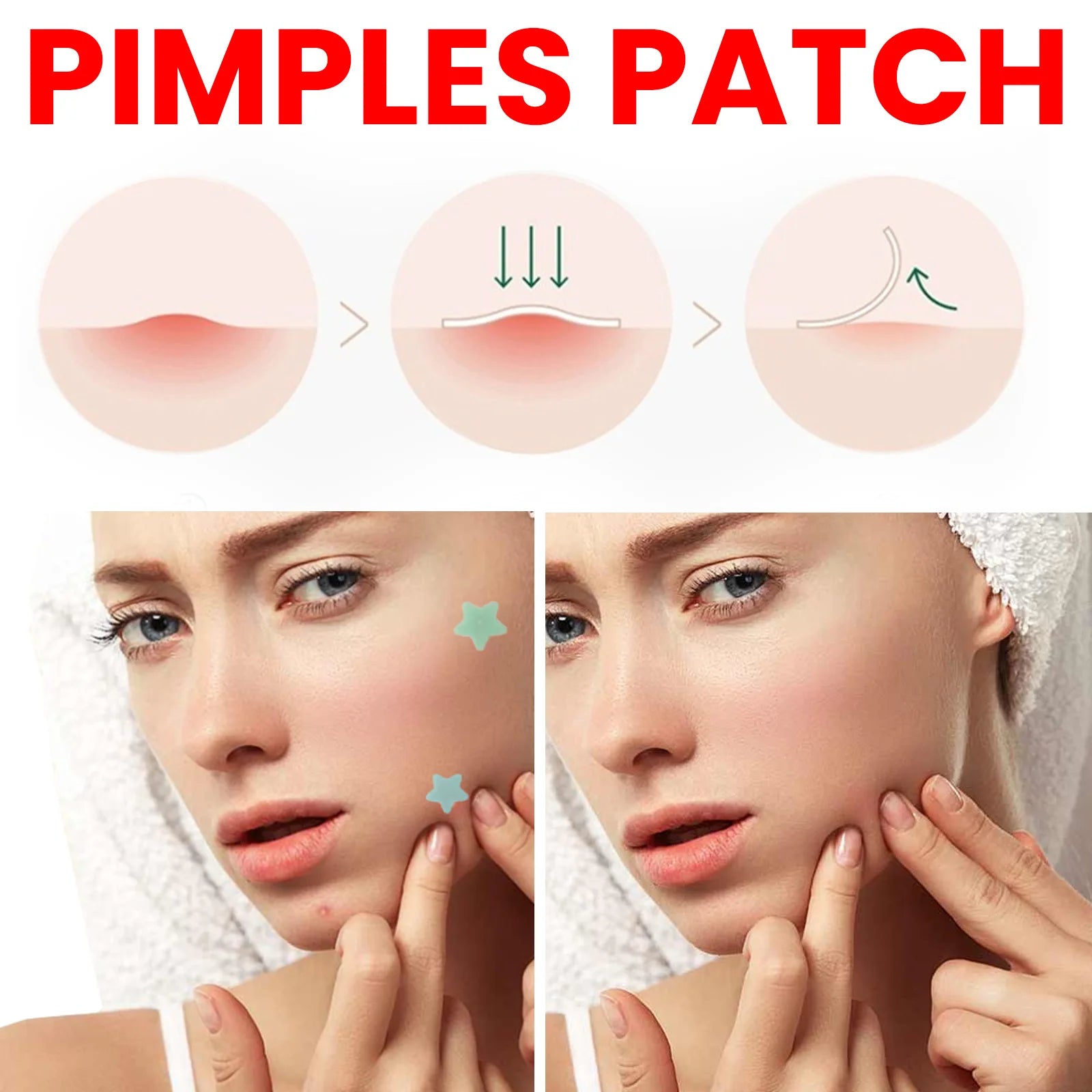 Pimples Patch Original Hydrocolloid Acne Covering Zits and Blemishes Miracle Clear Reduce Spot Stickers for Face Skin Care