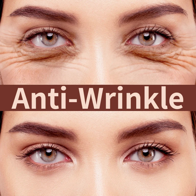 Retinol Anti-wrinkle Eye Cream Remove Eye Bags Dark Circles Fade Fine Lines Anti-Aging Puffiness Firm Brighten Eye Care Unisex