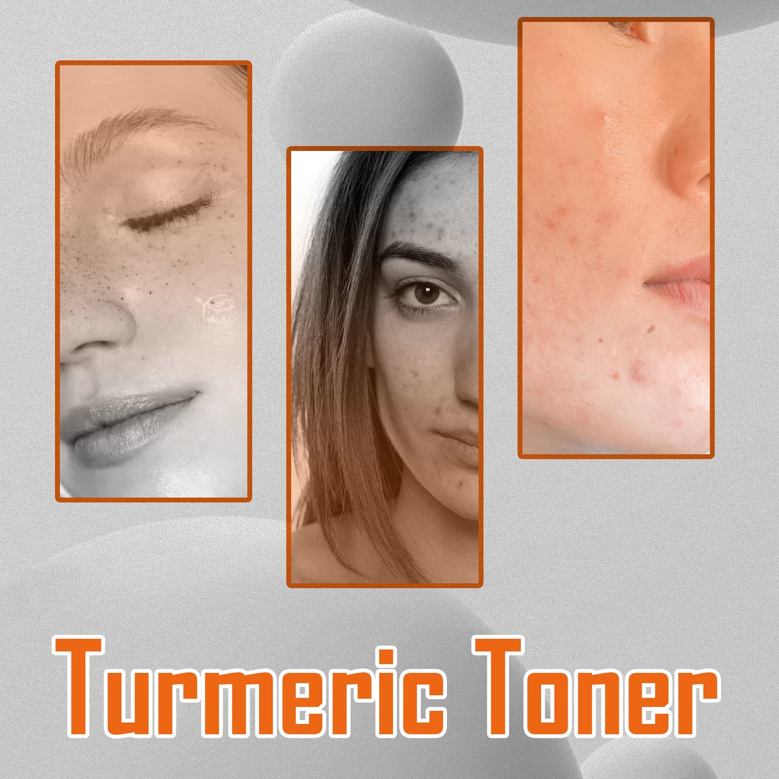 Dark Spots Removal Toner Whitening Spots Corrector Remove Freckle Lighten Melasma Pigmentation Moisturizing Turmeric Face Toner