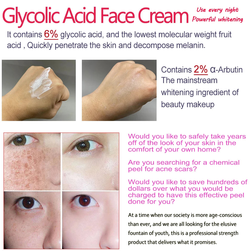 Gift Glycolic Acid Facial Cream AHA Body Cream Acne removal Pimple reduction Blemish control Breakout prevention Anti-acne