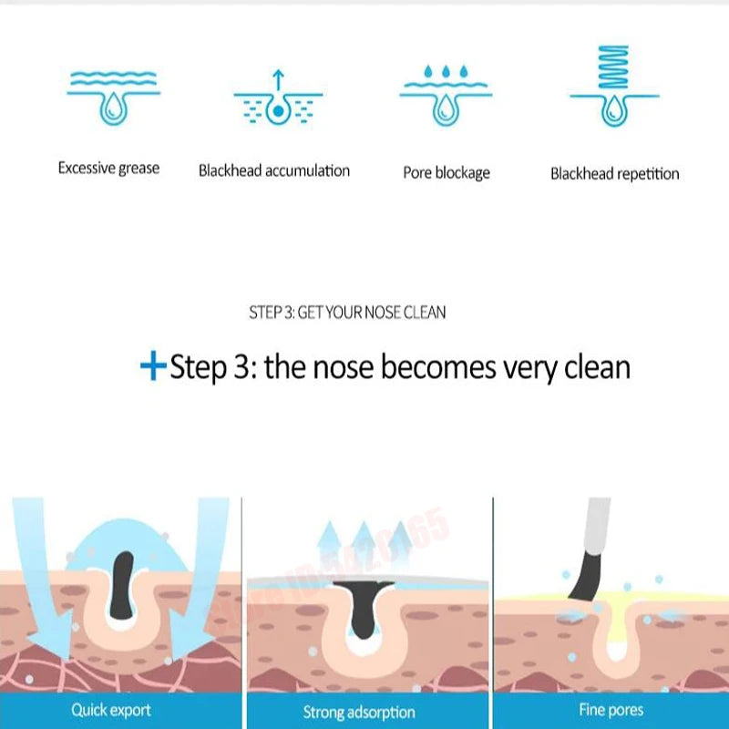 Nose Blackhead Peeling Solution Serum Facial Cleaning Liquid Scrub Special Solution Skin Deep Cleaning For Small Bubble