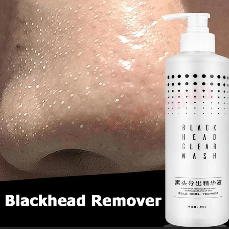 Nose Blackhead Peeling Solution Serum Facial Cleaning Liquid Scrub Special Solution Skin Deep Cleaning For Small Bubble