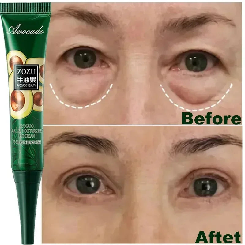 Anti Dark Circles Bags Instant Remove Wrinkles Eye Cream Puffiness Fade Eye Fine Line Tighten Whiten Under Eyes Skin Care New